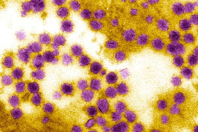 virus West Nile